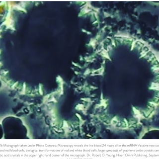 Shows blood cell alteration