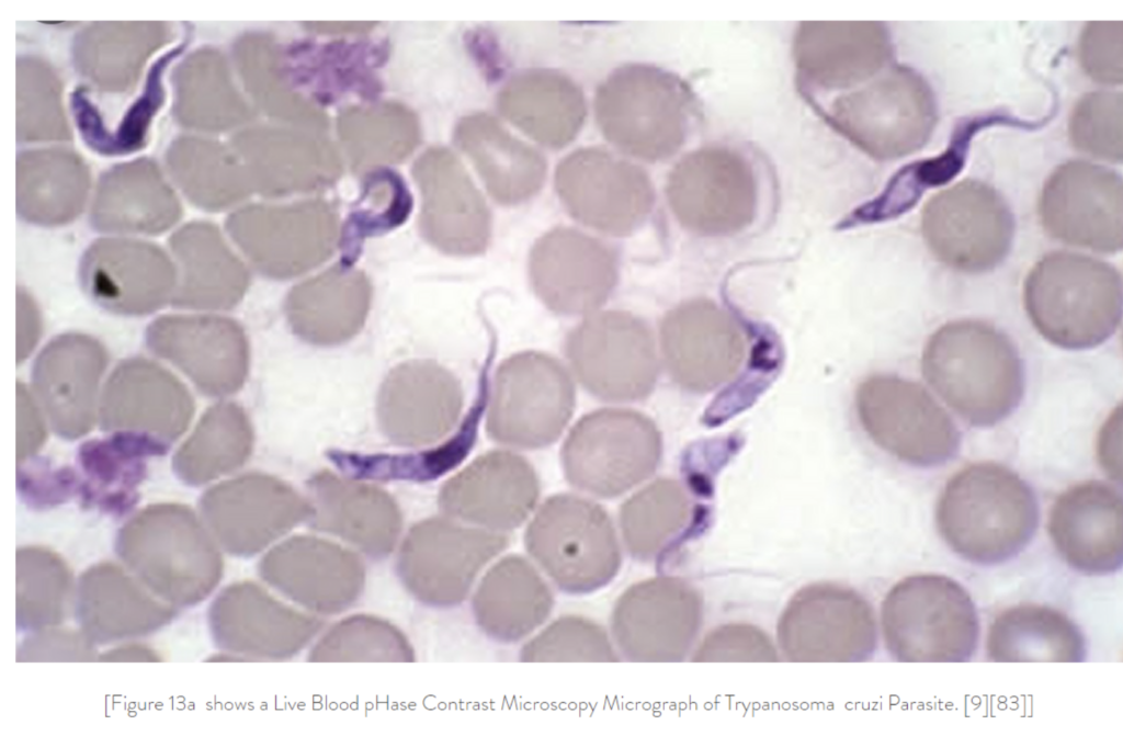 Trypanosoma Cruzi parasites among blood cells